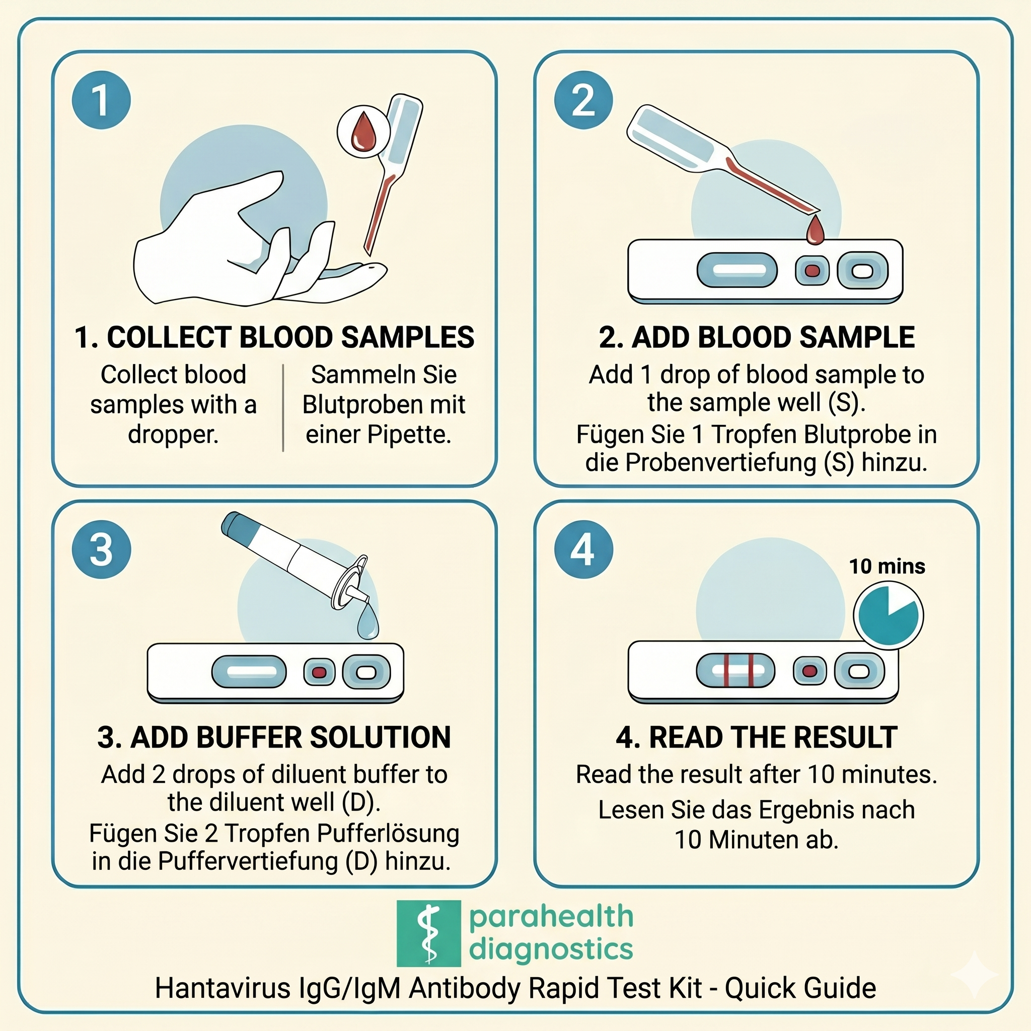 Test Hantavirus — Kit test rapido anticorpi IgG/IgM